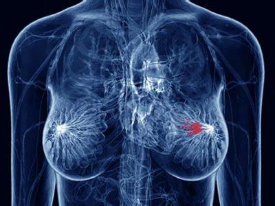 乳腺癌和HER2阳性疾病的生物学